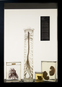 View of the exhibition Anatomies